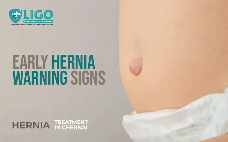 Early symptoms of hernia you should not ignore